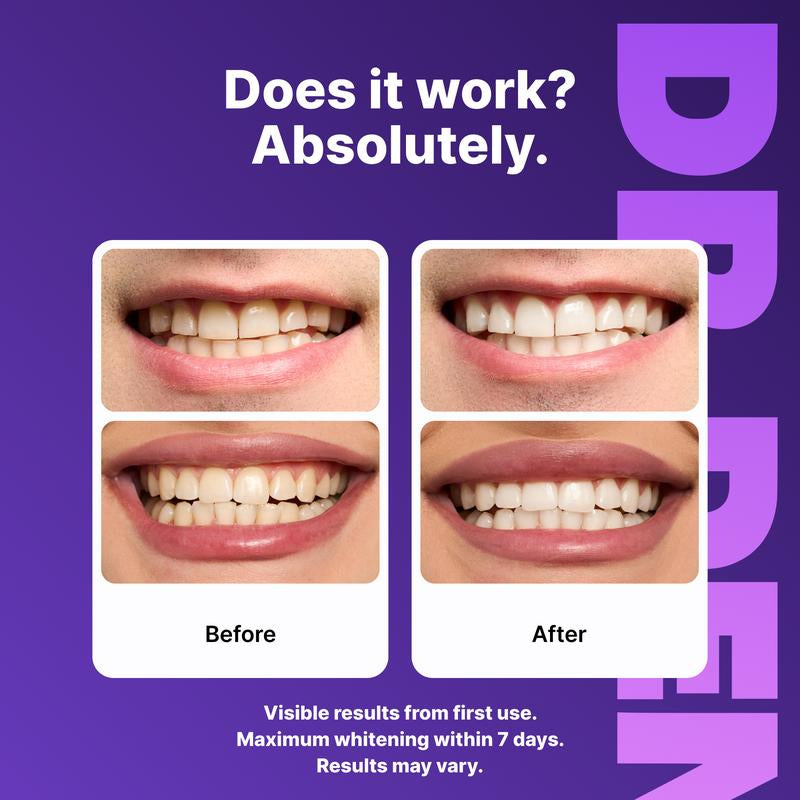 DRDENT Purple Teeth Whitening Strips